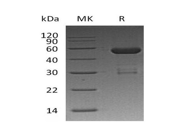 Human OTUB2 Recombinant Protein (RPES1901)