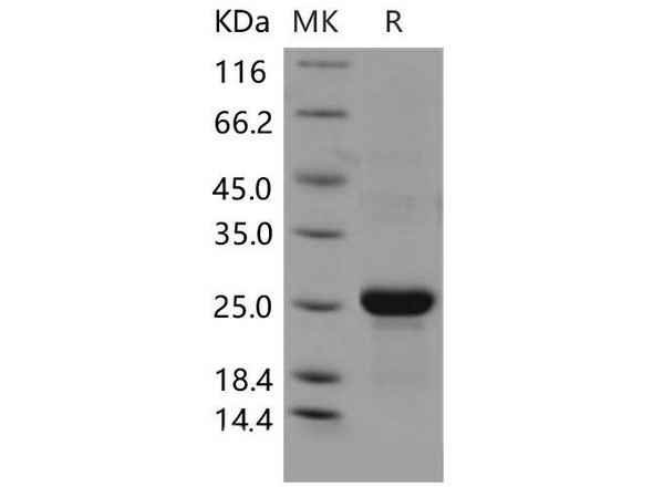 Mouse CLEC3B/Tetranectin Recombinant Protein (His Tag) (RPES1943)