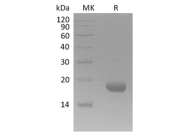 Human Interleukin7F/IL7F Recombinant Protein (RPES2061)