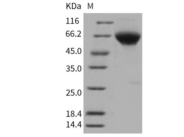 Human BMPR2 Recombinant Protein (RPES2075)