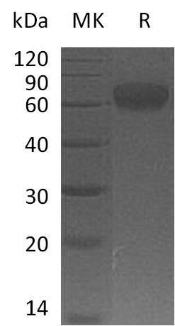 Human B7-H5/Gi24/VSIR Recombinant Protein (RPES2103)
