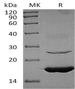 Human Ube2L6 Recombinant Protein (His Tag) (RPES2179)