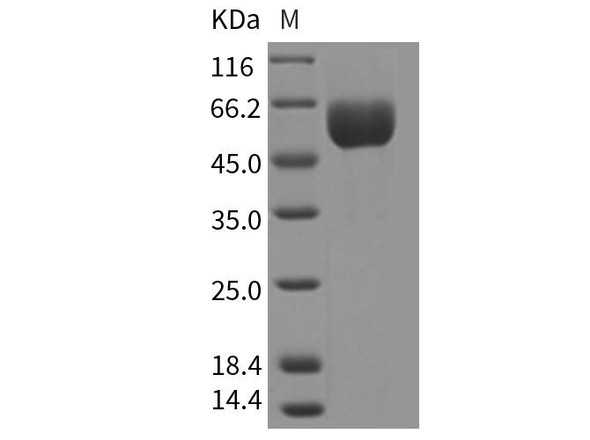 Mouse SMPDL3A Recombinant Protein (His Tag) (RPES2204)