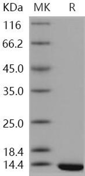 Human TXNDC17/TRP14/TXNL5 Recombinant Protein (RPES2222)