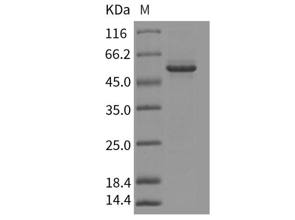 Mouse GFOD2 Recombinant Protein (His Tag) (RPES2224)