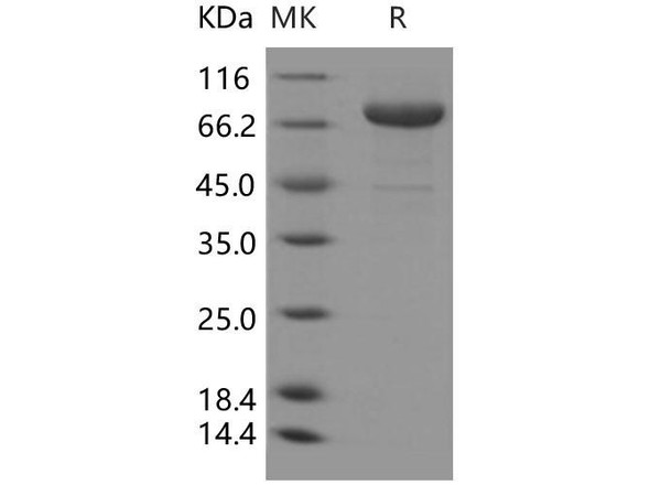 Transferrin Receptor/TFRC Recombinant Protein (RPES2247)
