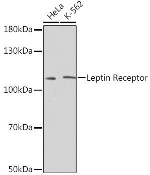 Anti-Leptin Receptor Antibody (CAB2999)
