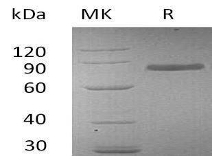 Human Transferrin Recombinant Protein (His Tag) (Active) (RPES2267)