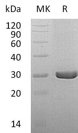 QDPR Recombinant Protein (RPES2352)