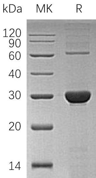 Human UROS/UROIIIS Recombinant Protein (RPES2355)