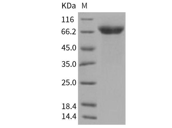 Human ADAM15 Recombinant Protein (HEK293 Cells, His Tag) (RPES2368)