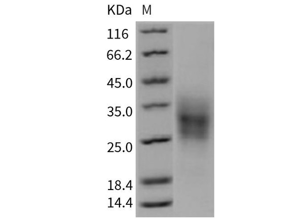 Mouse TRAIL R2/TNFRSF10B Recombinant Protein (RPES2371) Mouse TRAIL R2/TNFRSF10B Recombinant Protein (RPES2371)