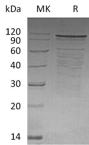 Human DLG4 Recombinant Protein (RPES2419)