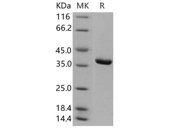 Human ACYP1 Recombinant Protein (GST Tag) (RPES2432)