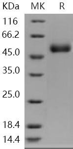 Human ACPL2 Recombinant Protein (His Tag) (RPES2433)