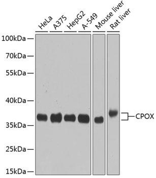 Anti-CPOX Antibody (CAB3807)