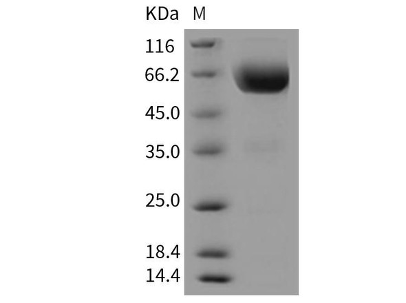 Mouse TIM-3/HAVCR2 Recombinant Protein (Fc Tag) (RPES2457)