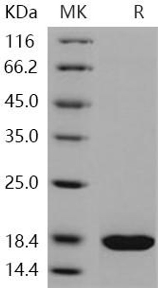 Human REG3A/HIP Recombinant Protein (RPES2475)