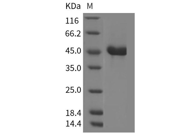 Mouse REG2/REG-2 Recombinant Protein (Fc Tag) (RPES2477)