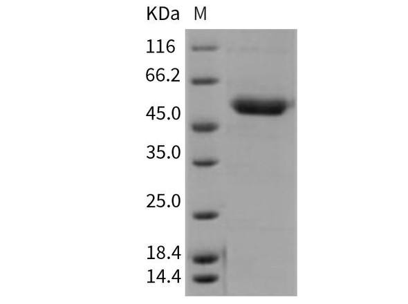 Mouse CD39/ENTPD1 Recombinant Protein (RPES2478)