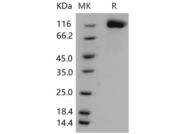 Mouse OSMR/IL-31RB Recombinant Protein (RPES2486)