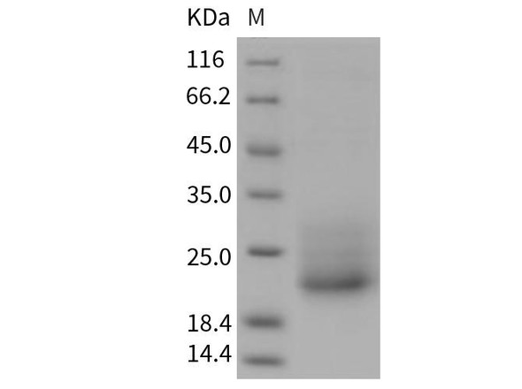 Mouse CD7 Recombinant Protein (His Tag) (Active) (RPES2517)