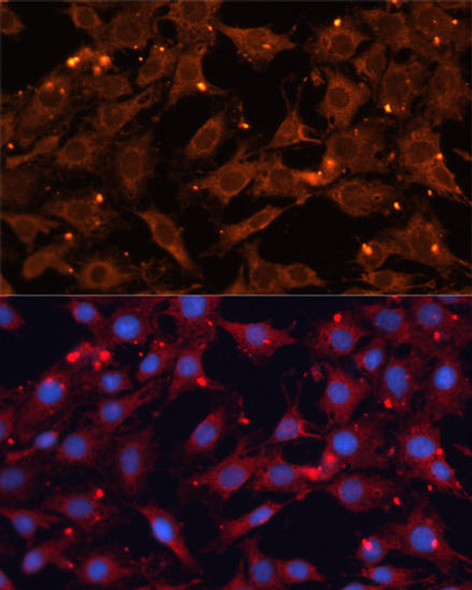 Anti-INPP5B Antibody (CAB3927)