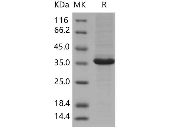 Human MAP1D Recombinant Protein (His Tag) (Active) (RPES2579)
