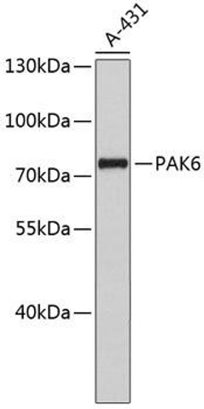 Anti-PAK6 Antibody (CAB4871)