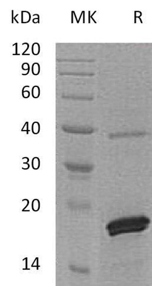 Human PRL-2/PTP4A2 Recombinant Protein (RPES2625)