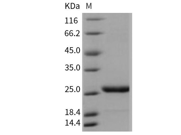 Mouse Prolactin/PRL Recombinant Protein (His Tag) (RPES2639)