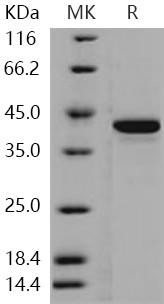 Human STK10/LOK Recombinant Protein (His Tag) (Active) (RPES2640)