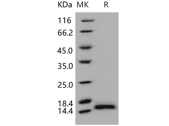Human PHPT1/PHP14 Recombinant Protein (His Tag) (RPES2698)