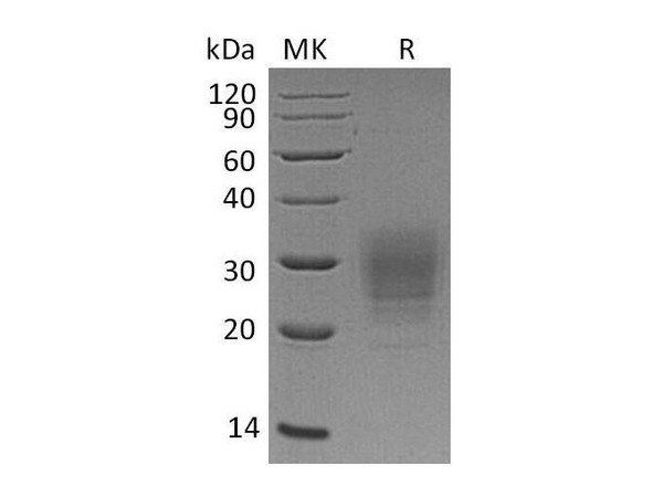 Human VSTM1 Recombinant Protein (RPES2710)