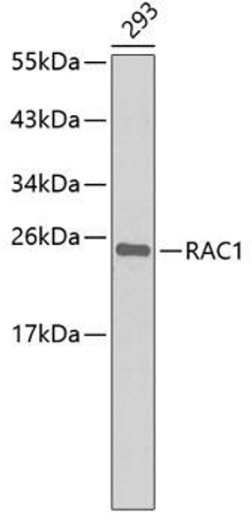 Anti-RAC1 Antibody (CAB5539)
