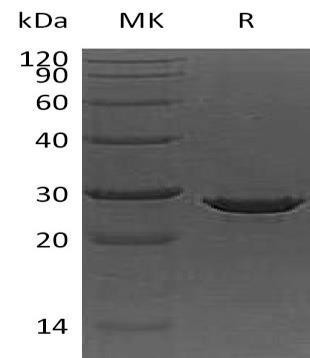 Apolipoprotein A-I/ApoAI Recombinant Protein (RPES2805)