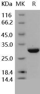 Human Carbonic Anhydrase II/CA2 Recombinant Protein (His Tag) (Active) (RPES2820)