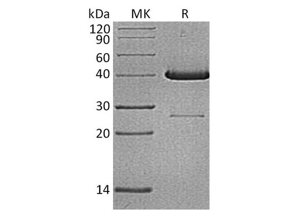 Human UBE2D1 Recombinant Protein (RPES2834)