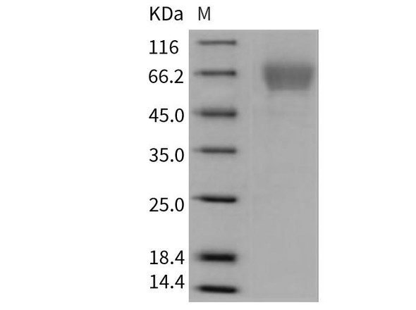 Mouse TIM4/TIMD4 Recombinant Protein (His Tag) (RPES2851)
