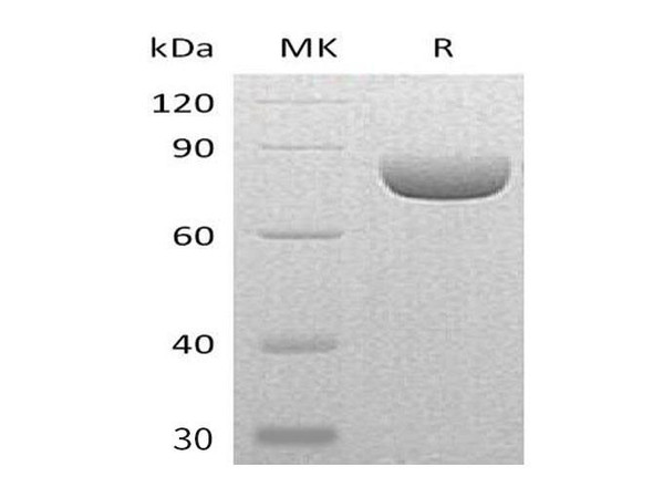 Mouse Semaphorin-4A/SEMA4A Recombinant Protein (RPES2852)