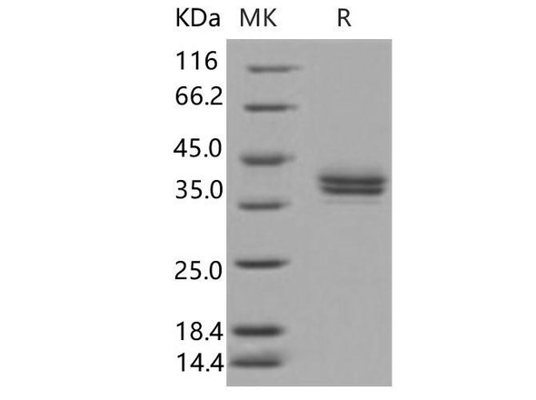 Human CADM3 Recombinant Protein (His Tag) (Active) (RPES2860)