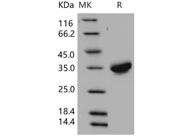 Human CXADR/CAR Recombinant Protein (His Tag) (Active) (RPES2887)