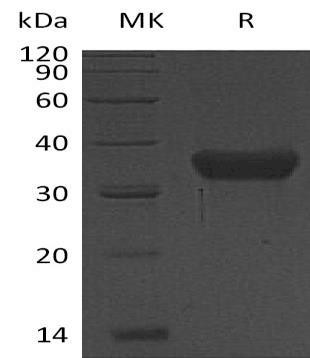 Human KLK-8/Kallikrein-8 Recombinant Protein (RPES2890)