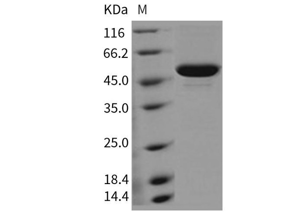 Mouse SES1D Recombinant Protein  (RPES2893)