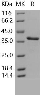 Carbonic Anhydrase 8/CA8 Recombinant Protein (RPES2903)