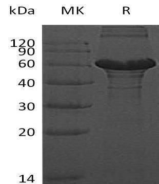 Human ZBTB9 Recombinant Protein (RPES2913)
