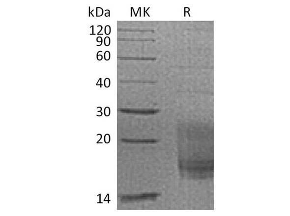 Cynomolgus TIGIT/VSIG9/VSTM3 Recombinant Protein (RPES2920)