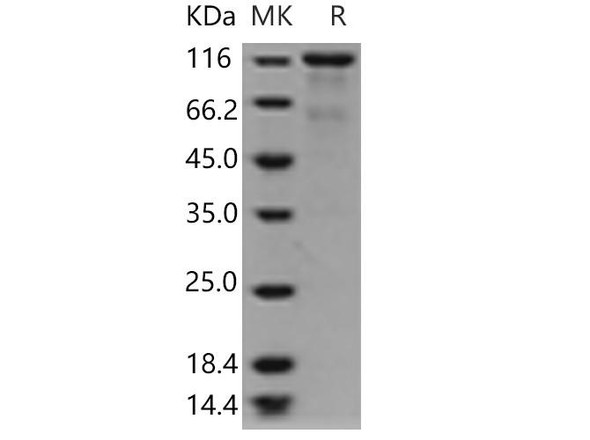 Human EPOR & CD131 Homodimer Recombinant Protein (Active) (RPES2921)