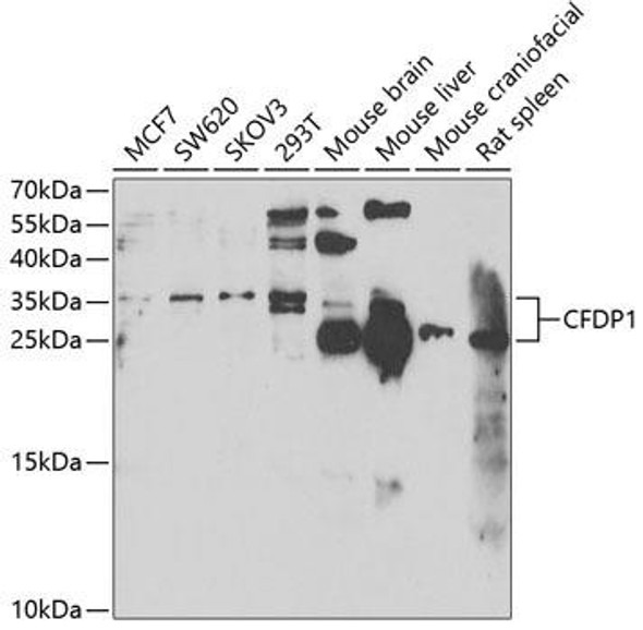 Anti-CFDP1 Antibody (CAB6325)