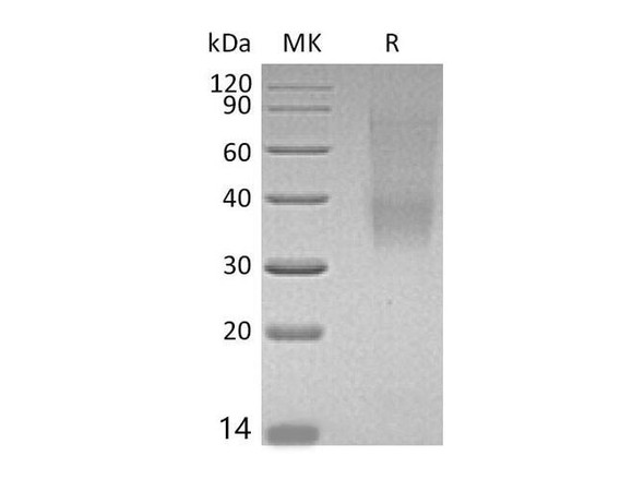 Mouse SLAMF9 Recombinant Protein (RPES3028)